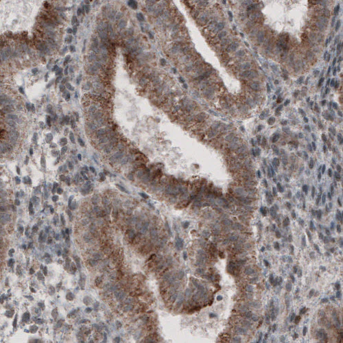 Immunohistochemistry (Formalin/PFA-fixed paraffin-embedded sections) - Anti-ACAA1 Antibody [CL2662] (AB327108)