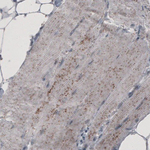 Immunohistochemistry (Formalin/PFA-fixed paraffin-embedded sections) - Anti-ACAA1 Antibody [CL2662] (AB327108)