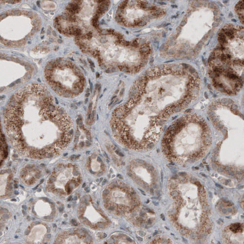 Immunohistochemistry (Formalin/PFA-fixed paraffin-embedded sections) - Anti-ACAA1 Antibody [CL2662] (AB327108)