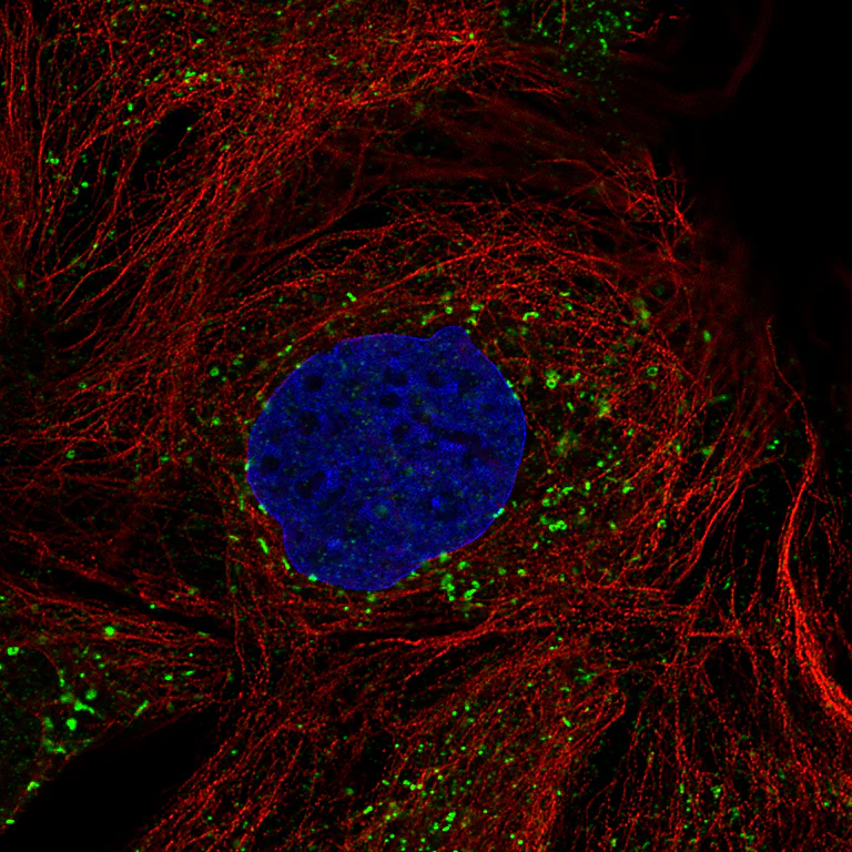 Immunocytochemistry/ Immunofluorescence - Anti-ACAA1 Antibody [CL2663] (AB327109)