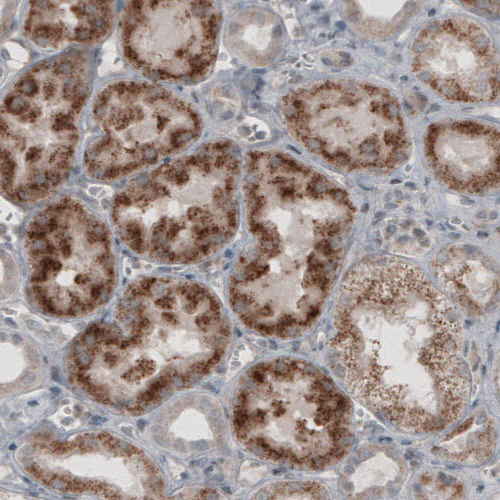 Immunohistochemistry (Formalin/PFA-fixed paraffin-embedded sections) - Anti-ACAA1 Antibody [CL2663] (AB327109)