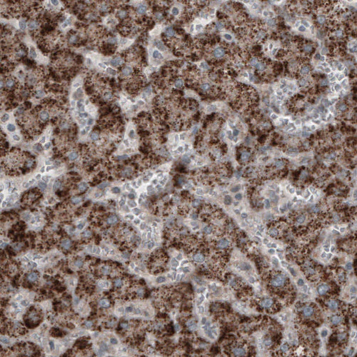 Immunohistochemistry (Formalin/PFA-fixed paraffin-embedded sections) - Anti-ACAA1 Antibody [CL2663] (AB327109)