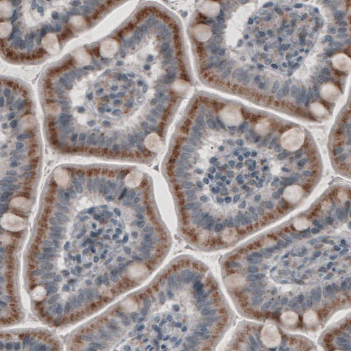 Immunohistochemistry (Formalin/PFA-fixed paraffin-embedded sections) - Anti-ACAA1 Antibody [CL2663] (AB327109)