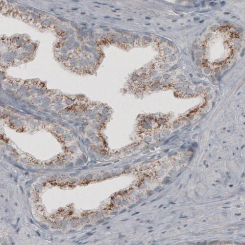 Immunohistochemistry (Formalin/PFA-fixed paraffin-embedded sections) - Anti-ACAA1 Antibody [CL2663] (AB327109)