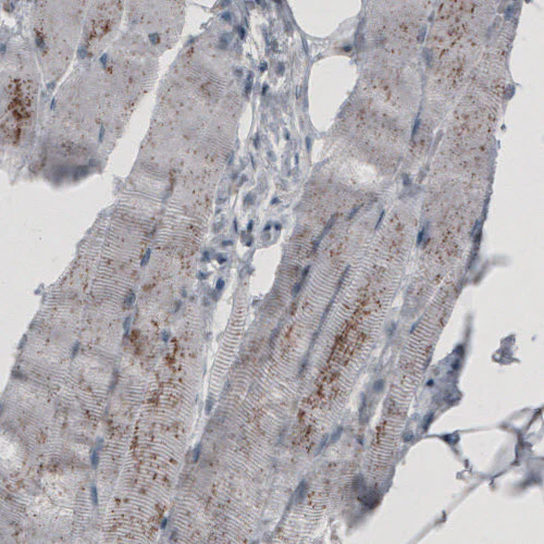 Immunohistochemistry (Formalin/PFA-fixed paraffin-embedded sections) - Anti-ACAA1 Antibody [CL2663] (AB327109)
