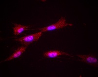 Immunocytochemistry - Anti-ACAA1/Beta-ketothiolase antibody [2H6BE7] (AB110289)
