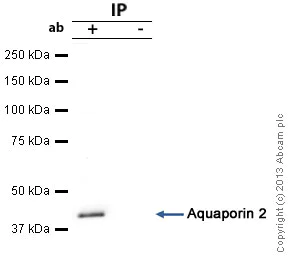 Immunoprecipitation - Anti-ACAA1/Beta-ketothiolase antibody [2H6BE7] (AB110289)