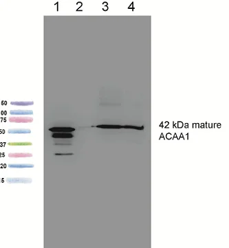 Western blot - Anti-ACAA1/Beta-ketothiolase antibody [2H6BE7] (AB110289)