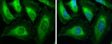 Immunohistochemistry (Formalin/PFA-fixed paraffin-embedded sections) - Anti-ACAA1/Beta-ketothiolase antibody (AB154091)