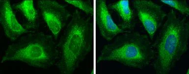 Immunohistochemistry (Formalin/PFA-fixed paraffin-embedded sections) - Anti-ACAA1/Beta-ketothiolase antibody (AB154091)