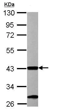 Western blot - Anti-ACAA1/Beta-ketothiolase antibody (AB154091)