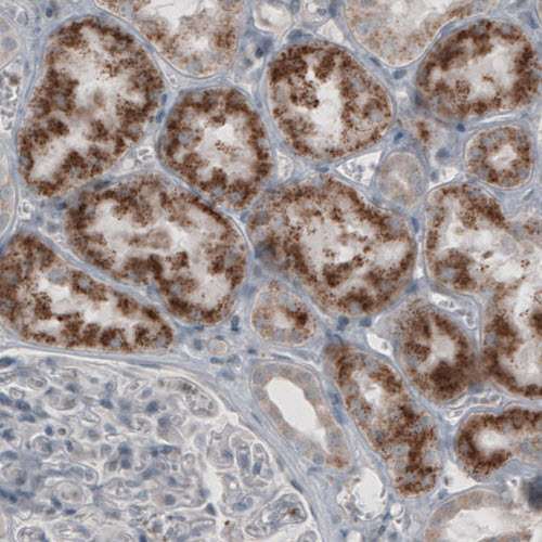 Immunohistochemistry (Formalin/PFA-fixed paraffin-embedded sections) - Anti-ACAA1/Beta-ketothiolase antibody [CL2650] (AB210961)