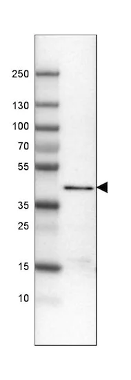 Western blot - Anti-ACAA1/Beta-ketothiolase antibody [CL2650] (AB210961)