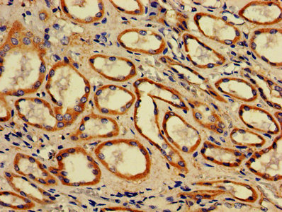 Immunohistochemistry (Formalin/PFA-fixed paraffin-embedded sections) - Anti-ACAA2 antibody (AB237540)
