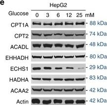 Western blot - Anti-ACAA2 antibody [EPR6732(2)] (ab128929), expandable thumbnail
