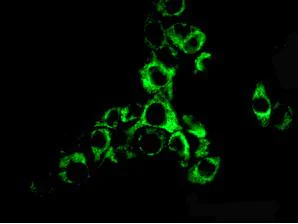Immunocytochemistry/ Immunofluorescence - Anti-ACAA2 antibody [EPR6732(2)] - BSA and Azide free (AB248228)