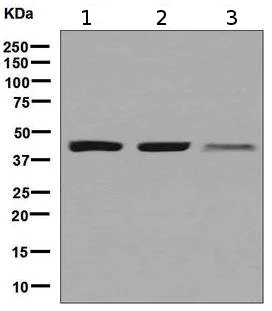 Western blot - Anti-ACAA2 antibody [EPR6732(2)] - BSA and Azide free (AB248228)