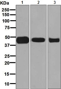 Western blot - Anti-ACAA2 antibody [EPR6733] (AB128911), expandable thumbnail
