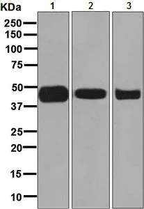 Western blot - Anti-ACAA2 antibody [EPR6733] (AB128911)