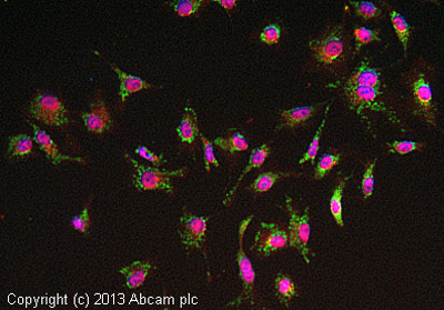 Immunocytochemistry/ Immunofluorescence - Anti-ACAA2 antibody [EPR6733] - BSA and Azide free (AB248216)