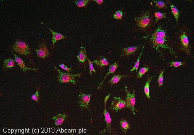Immunocytochemistry/ Immunofluorescence - Anti-ACAA2 antibody [EPR6733] - BSA and Azide free (AB248216)