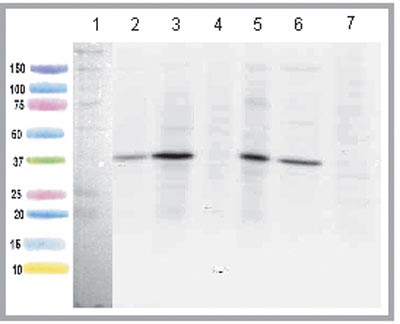 Western blot - Anti-ACADL/LCAD antibody [7F5DD6] (AB128566)