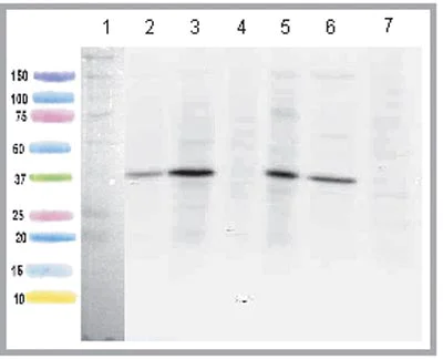 Western blot - Anti-ACADL/LCAD antibody [7F5DD6] (AB128566)