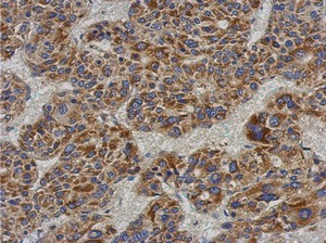 Immunohistochemistry (Formalin/PFA-fixed paraffin-embedded sections) - Anti-ACADL/LCAD antibody (AB152160)