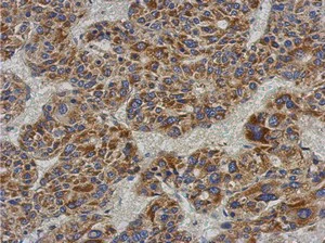 Immunohistochemistry (Formalin/PFA-fixed paraffin-embedded sections) - Anti-ACADL/LCAD antibody (AB152160)