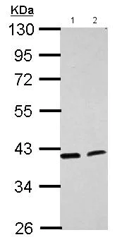 Western blot - Anti-ACADL/LCAD antibody (AB152160)