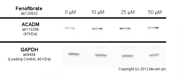 Western blot - Anti-ACADM/MCAD antibody [3B7BH7] (AB110296), expandable thumbnail