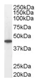 Western blot - Anti-ACADM/MCAD antibody (AB13677)