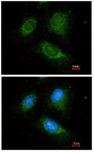 Immunocytochemistry/ Immunofluorescence - Anti-ACADM/MCAD antibody (AB152115), expandable thumbnail
