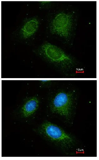 Immunocytochemistry/ Immunofluorescence - Anti-ACADM/MCAD antibody (AB152115)