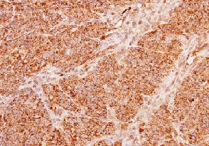 Immunohistochemistry (Formalin/PFA-fixed paraffin-embedded sections) - Anti-ACADM/MCAD antibody (AB152115), expandable thumbnail