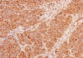 Immunohistochemistry (Formalin/PFA-fixed paraffin-embedded sections) - Anti-ACADM/MCAD antibody (AB152115)