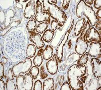 Immunohistochemistry (Formalin/PFA-fixed paraffin-embedded sections) - Anti-ACADM/MCAD antibody [EPR3707] - BSA and Azide free (AB247603)