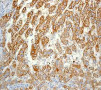 Immunohistochemistry (Formalin/PFA-fixed paraffin-embedded sections) - Anti-ACADM/MCAD antibody [EPR3707] - BSA and Azide free (AB247603)