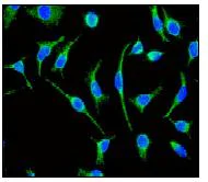 Immunocytochemistry/ Immunofluorescence - Anti-ACADM/MCAD antibody [EPR3708] (AB92461)