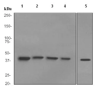 Western blot - Anti-ACADM/MCAD antibody [EPR3708] (AB92461)