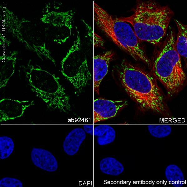 Immunocytochemistry/ Immunofluorescence - Anti-ACADM/MCAD antibody [EPR3708] - BSA and Azide free (AB239914), expandable thumbnail