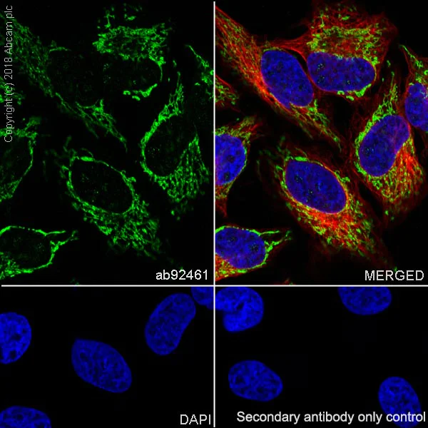 Immunocytochemistry/ Immunofluorescence - Anti-ACADM/MCAD antibody [EPR3708] - BSA and Azide free (AB239914)