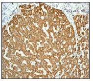 Immunohistochemistry (Formalin/PFA-fixed paraffin-embedded sections) - Anti-ACADM/MCAD antibody [EPR3708] - BSA and Azide free (AB239914)
