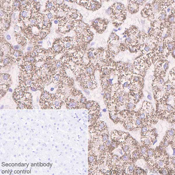 Immunohistochemistry (Formalin/PFA-fixed paraffin-embedded sections) - Anti-ACADM/MCAD antibody [EPR3708] - BSA and Azide free (AB239914), expandable thumbnail