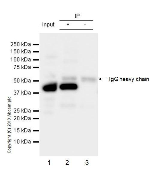 Immunoprecipitation - Anti-ACADM/MCAD antibody [EPR3708] - BSA and Azide free (AB239914), expandable thumbnail