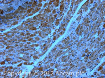 Immunohistochemistry (Formalin/PFA-fixed paraffin-embedded sections) - Anti-ACADS/SCAD antibody [7E1AB5] (AB110318), expandable thumbnail