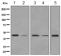 Western blot - Anti-ACADS/SCAD antibody [EPR10861(B)] - BSA and Azide free (AB249129)