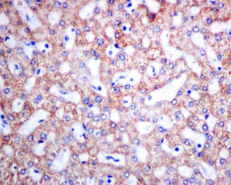 Immunohistochemistry (Formalin/PFA-fixed paraffin-embedded sections) - Anti-ACADS/SCAD antibody [EPR10862(B)] (AB156571)