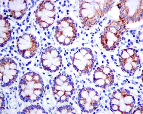 Immunohistochemistry (Formalin/PFA-fixed paraffin-embedded sections) - Anti-ACADS/SCAD antibody [EPR10862(B)] (AB156571)