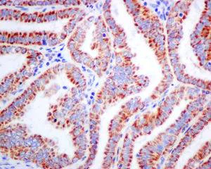 Immunohistochemistry (Formalin/PFA-fixed paraffin-embedded sections) - Anti-ACADS/SCAD antibody [EPR10862(B)] (AB156571)